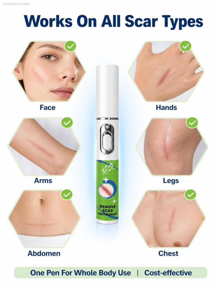 ZKRICARO Handheld Skin Beauty  - đánh giá và giá Home Improvement Visualizer